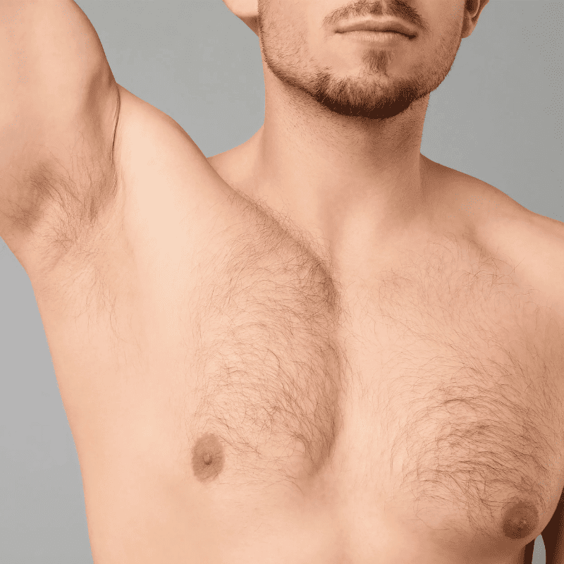 Imagem antes - Desktop